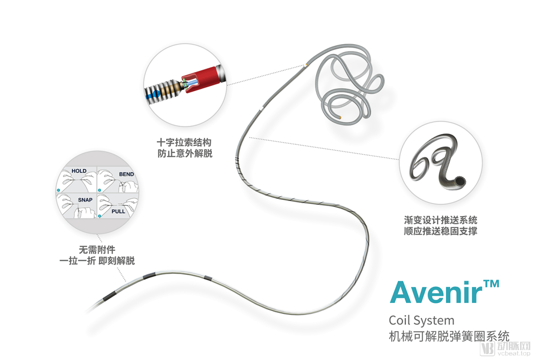 2019年,沃比医疗自主研发的机械解脱弹簧圈率先在美国获得fda批准