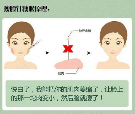 瘦肩膀针害死人了图片