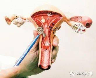 《妇幼之声》—必须了解的宫颈癌疫苗知识