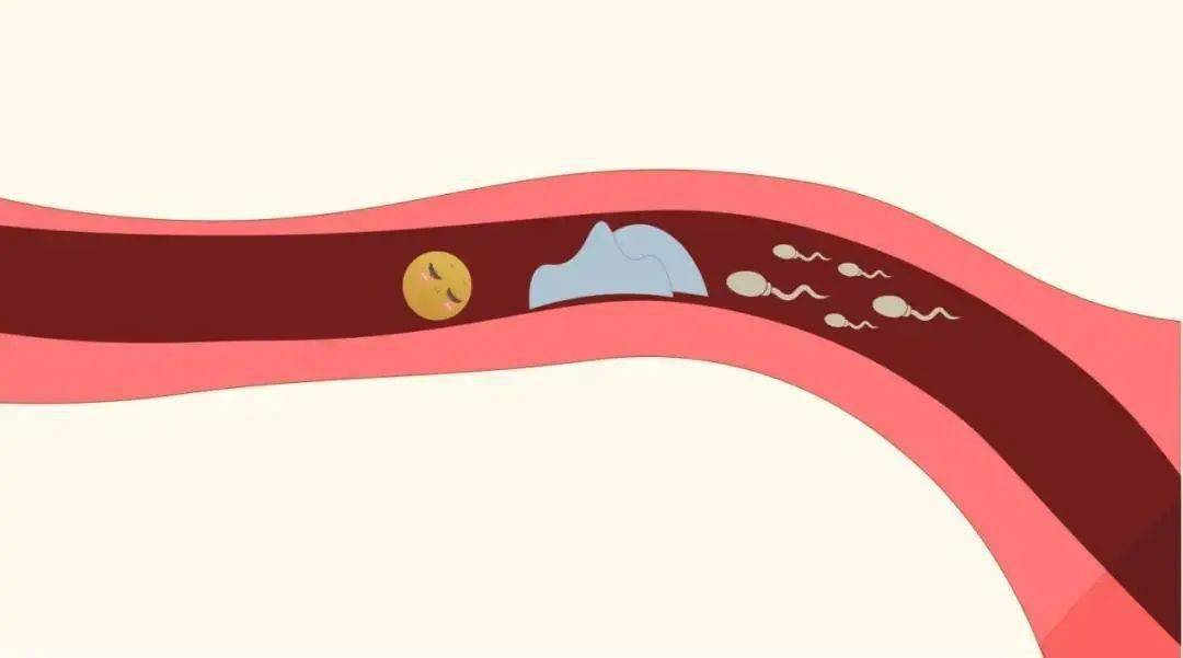 備孕路上遇到輸卵管堵塞怎麼辦