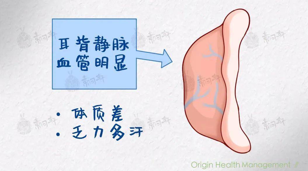 耳后静脉三条图片图片