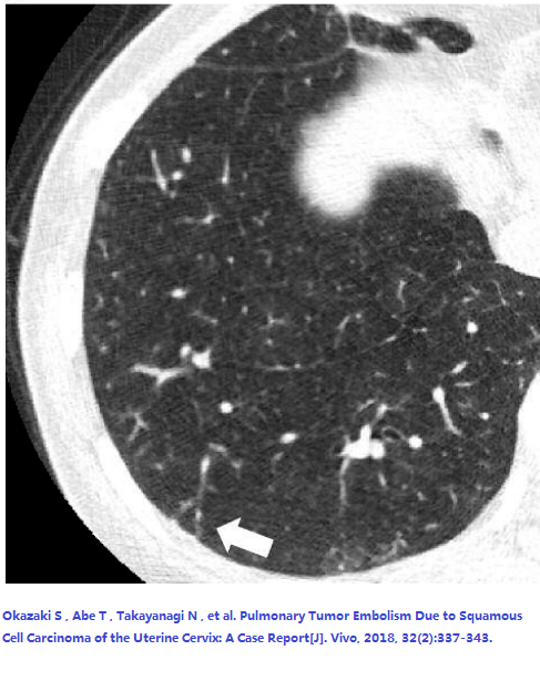 什么是动脉扩张 ec602cf048594e7ba8e875f87fb55c3e.png