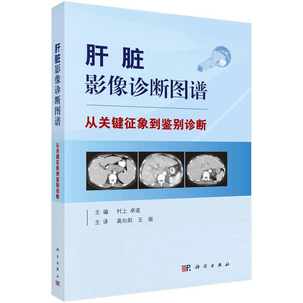 思考的技术要点 407272c984d9412b8ca495db4044879a.jpeg