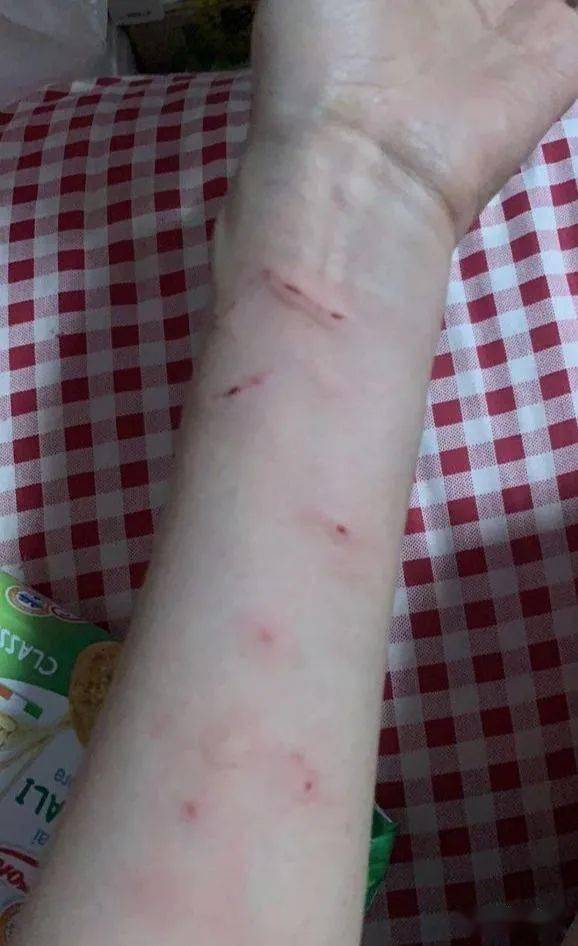 收留了一只流浪猫,然后第二天胳膊就它抓成这样,我好难_猫咪