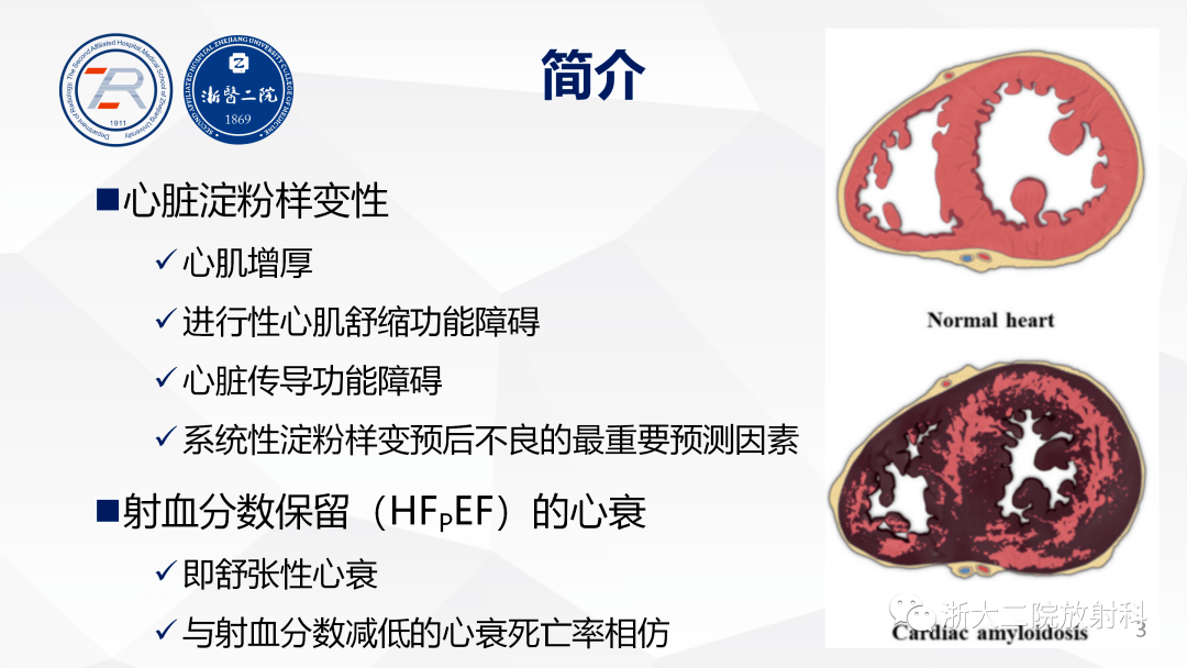 主持并参与多项省级及国家级课题主要方向为心血管系统影像诊断及鉴别