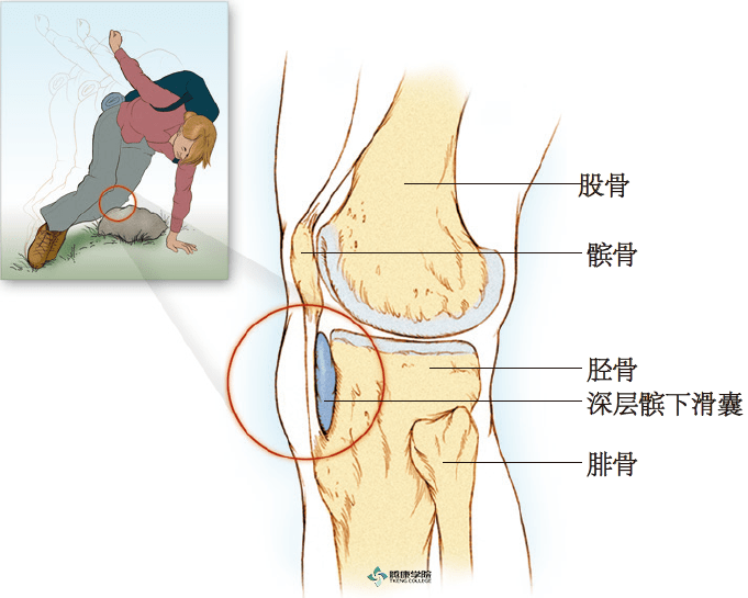膝盖滑囊位置图片图片