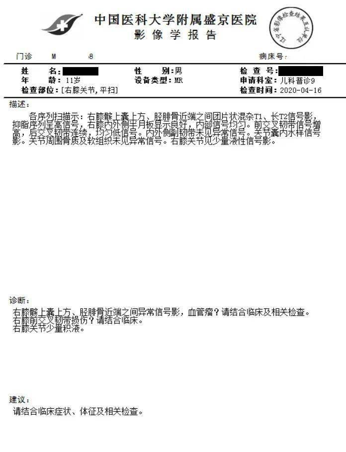 超聲引導下靜脈畸形泡沫硬化治療小穿刺解決大困擾