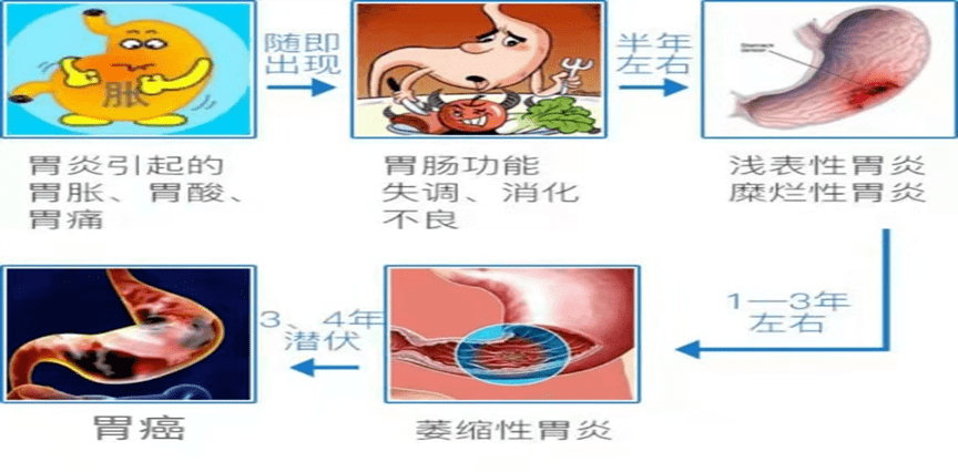 hp 相關性胃炎的進展通常有以下兩種形式:一種是胃竇為主的炎症,病情