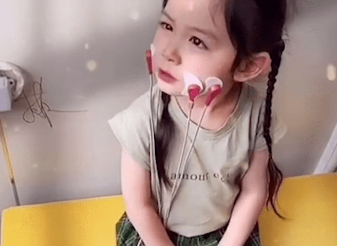 4岁女孩拥有"天使面孔"却患罕见基因病 6个月被发现发育迟缓