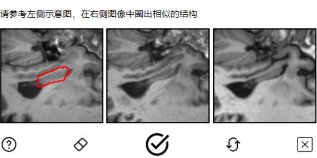 MedCAPTCHA|腾讯联合推出首个医学图像验证码 解决医学标注难题