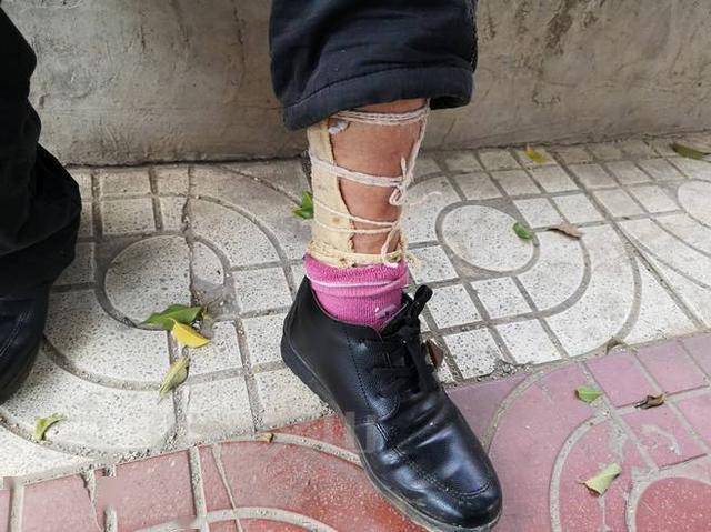 老人名叫黄保英,今年已有80岁了,腿脚残疾多年,平时都是依靠拐棍行走