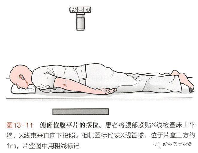 影像科遇到急腹症如何摆位如何读片总结4个体位仰卧俯卧立位腹平片立