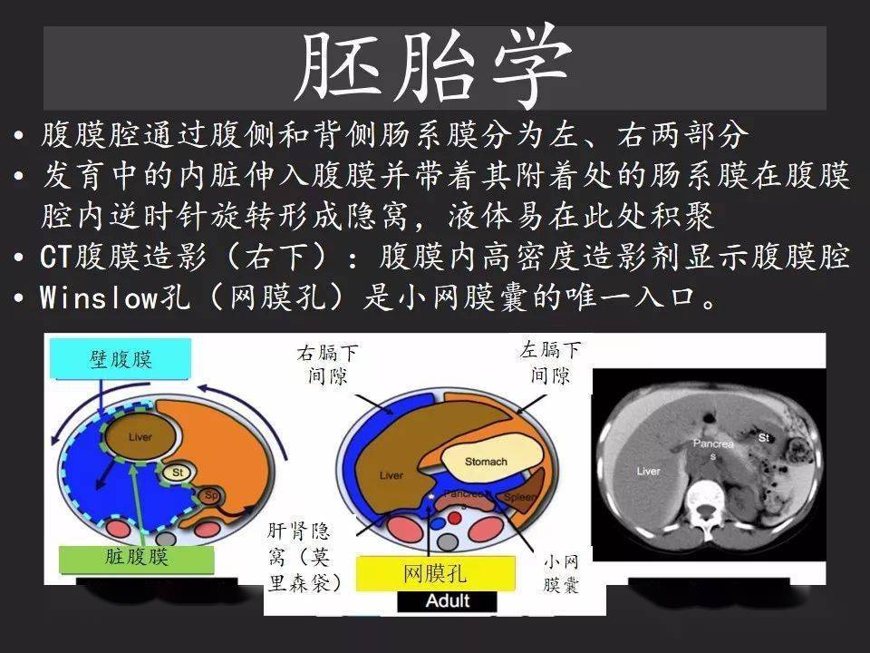 胃腸穿孔氣從哪裡來通過腹膜解剖確定穿孔部位