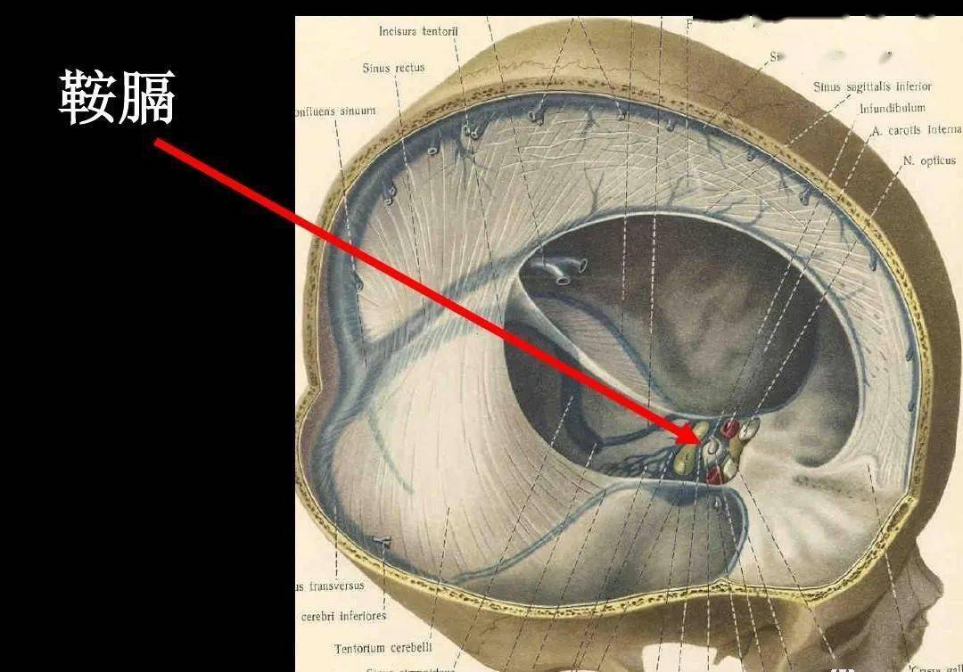高清解剖脑室脑池脑膜