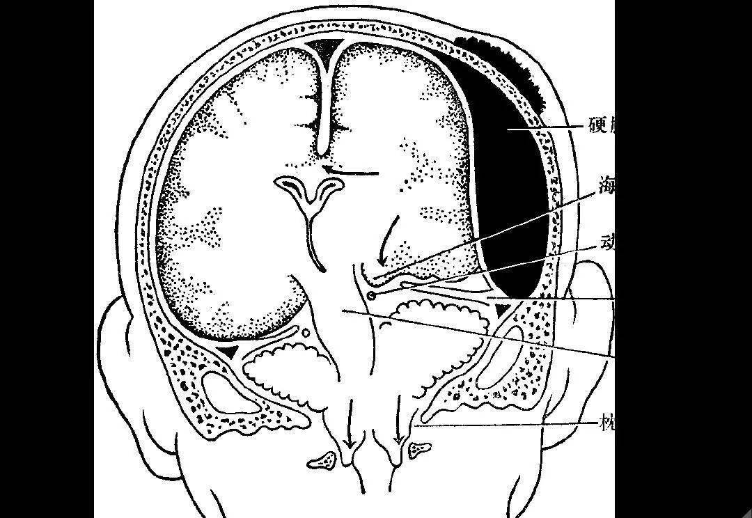 高清解剖脑室脑池脑膜