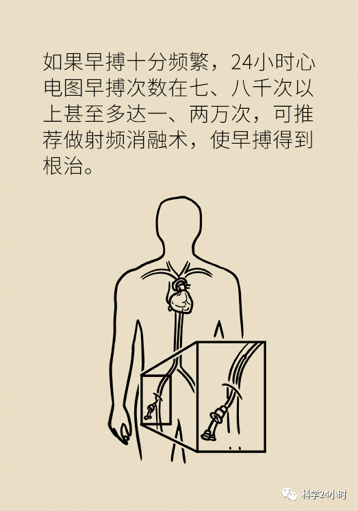 【科普生活】心脏早搏咋回事？