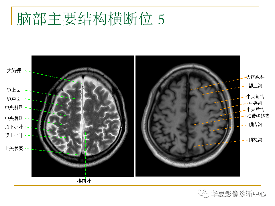 头颅mri矢状位解剖图片