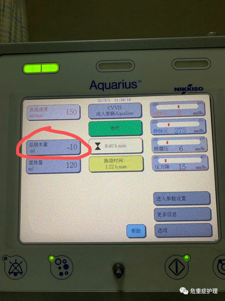 crrt总脱水量显示为负数,你见过吗?