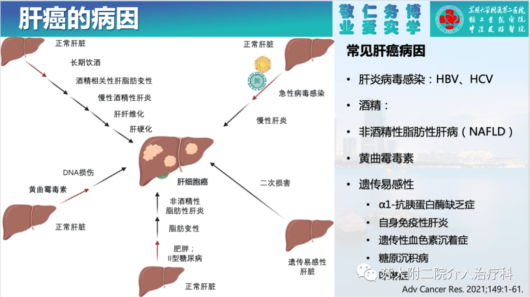 癌症肝癌十大信号_癌症肝癌早期能治愈吗_肝癌症前期的18种预兆