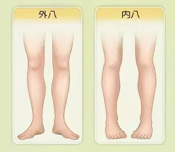 髋关节