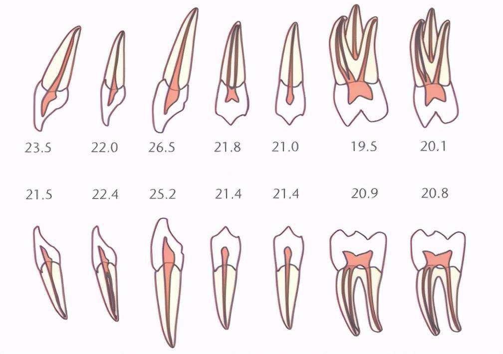 乳牙根管数量图片