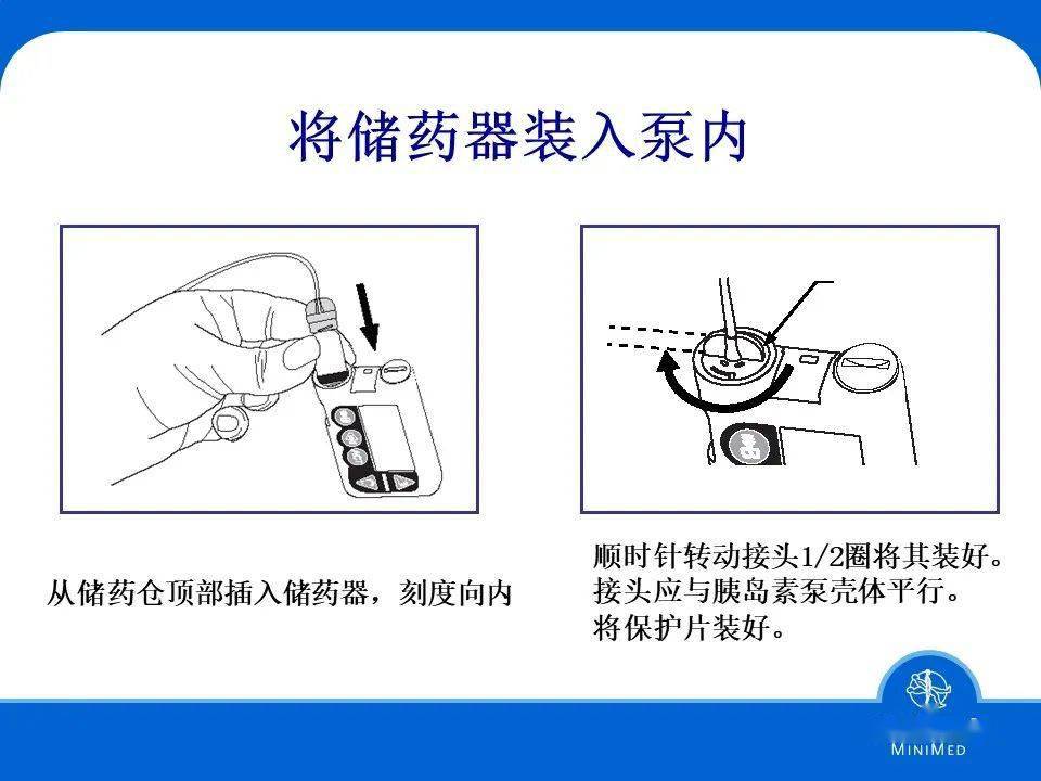 胰岛素泵使用方法图解图片