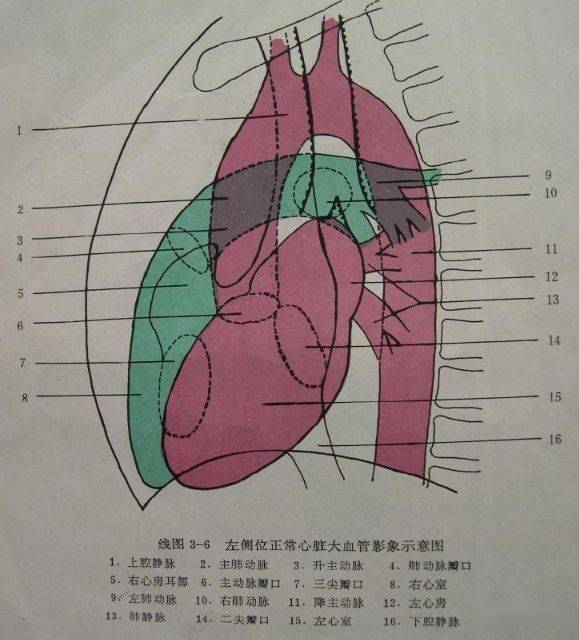 临床必备正常心脏和大血管的x线表现存起来