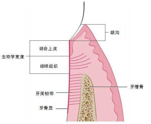 图1 牙周组织解剖图牙周组织由牙龈,牙周膜,牙骨质和牙槽骨构成(图1)