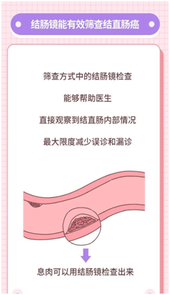 胃癌排名_胃癌晚期图片(3)