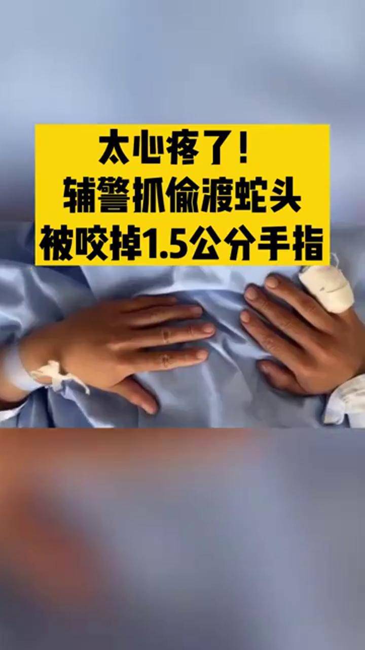 大拇指蛇头手指图片