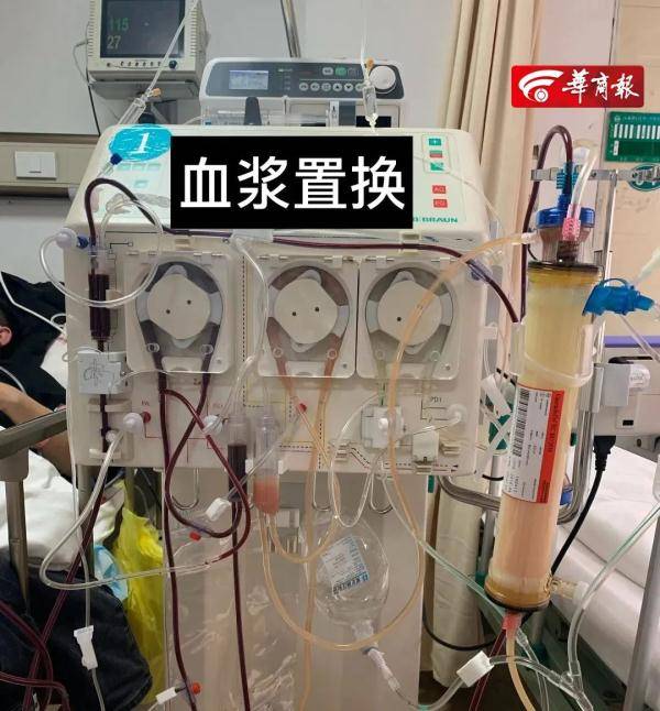 前一晚烤肉啤酒后西安32岁小伙竟抽出牛奶血