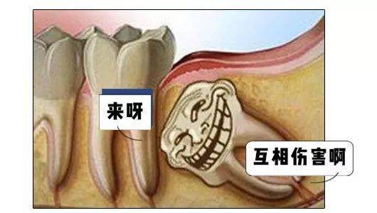 拔了智齒真的可以瘦臉嗎健康日曆