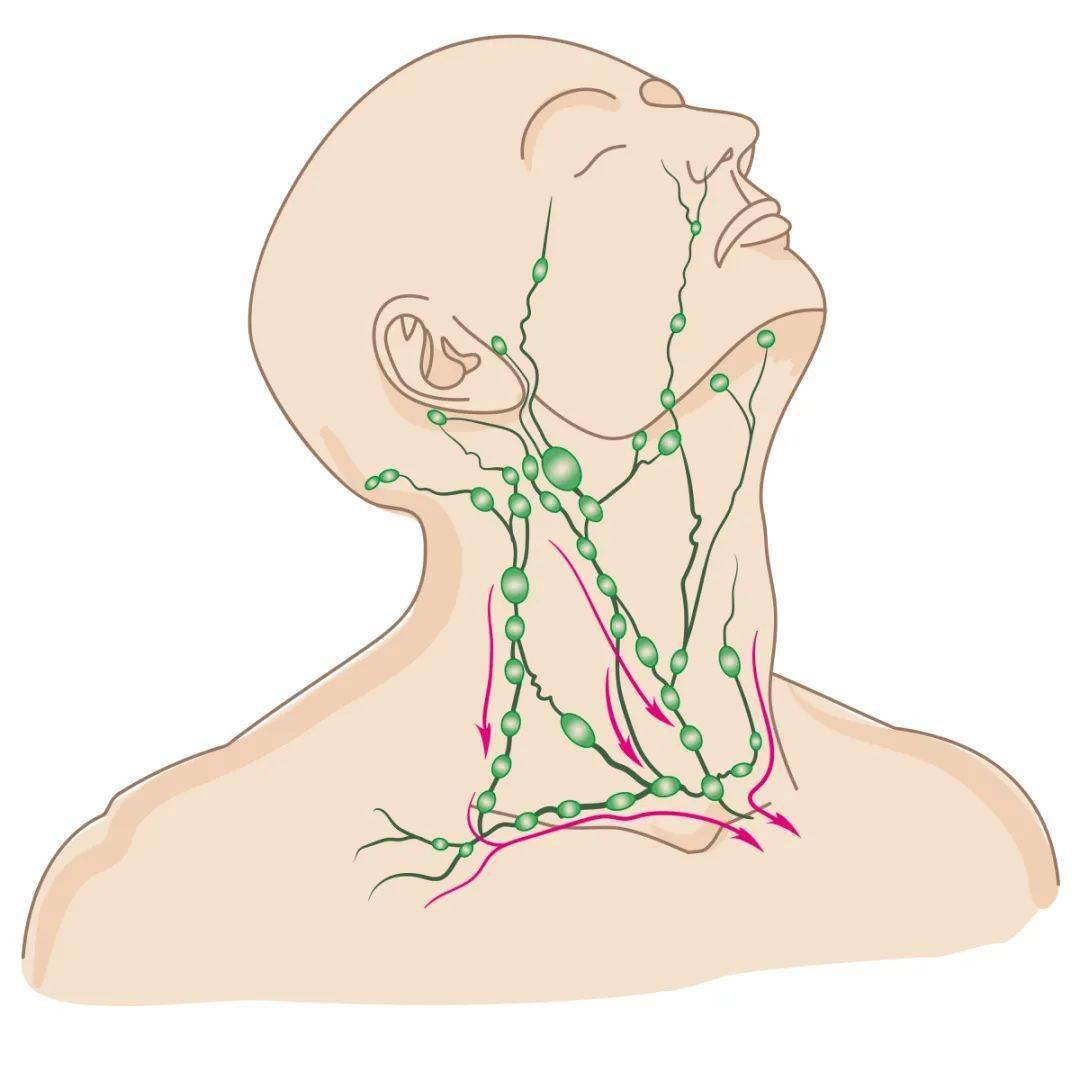 淋巴結腫大是癌變前兆嗎?_腫瘤