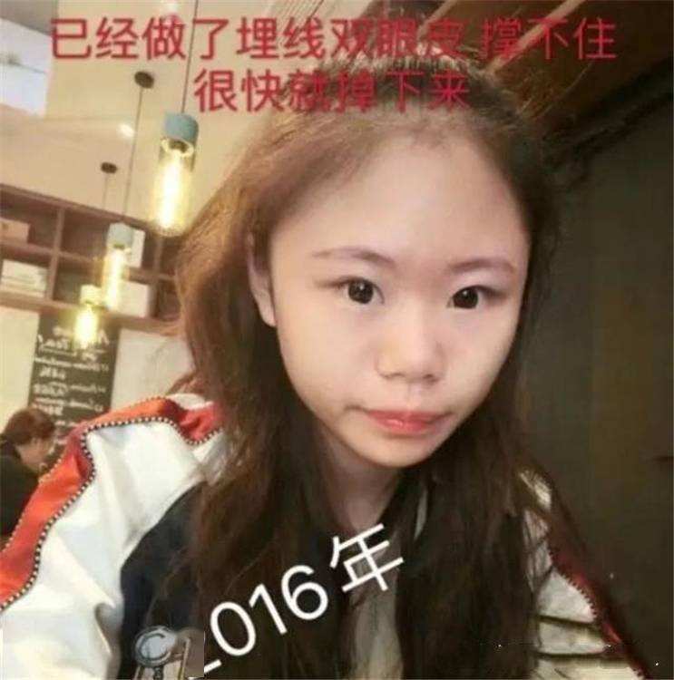 15岁女孩花400多万整容后悔整太早想知道自己自然长大的样子