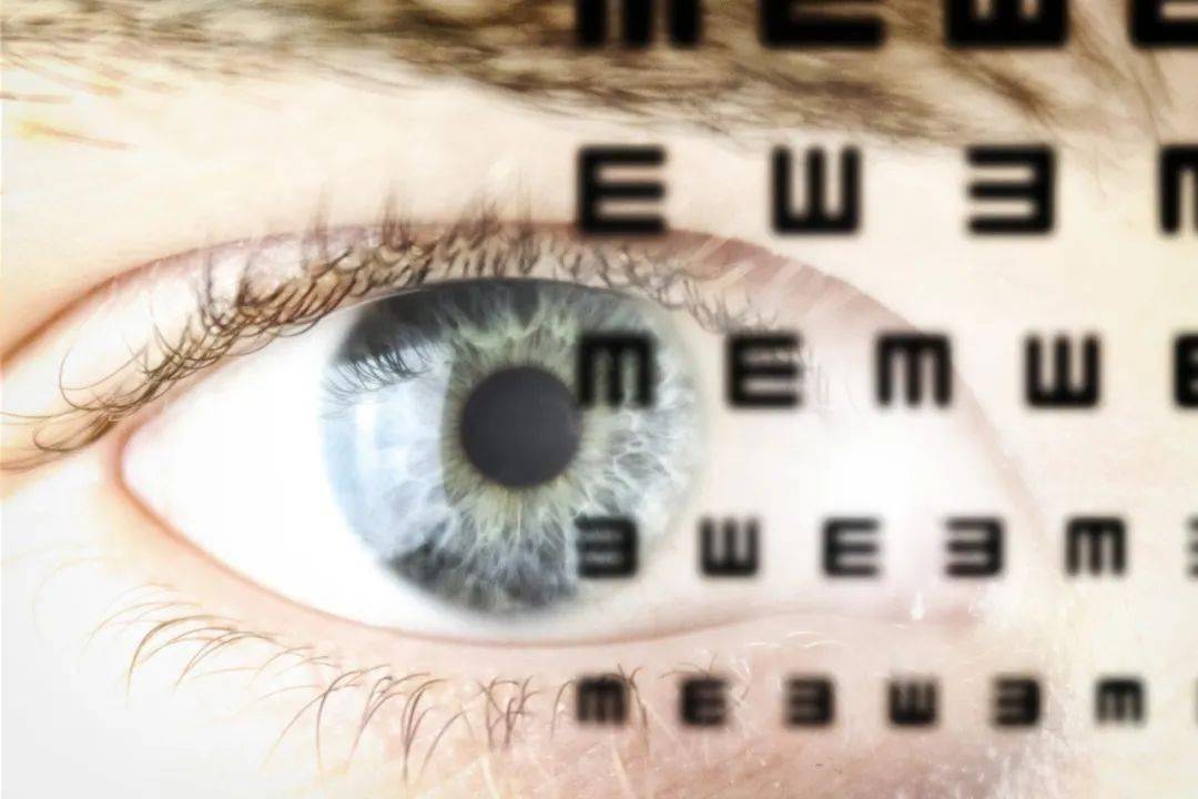 医院检查视力散瞳要多长时间 baee1d6aab7c4f14afa4ac7178518af5.jpeg