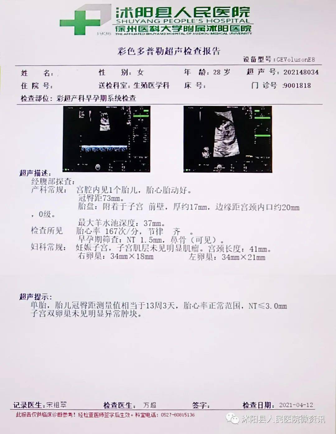 备孕3年无果1次生化妊娠沭医助她逆袭当妈妈