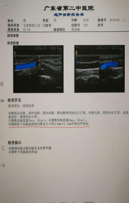 以案說醫王清海益氣活血化痰法消除鎖骨下動脈斑塊案