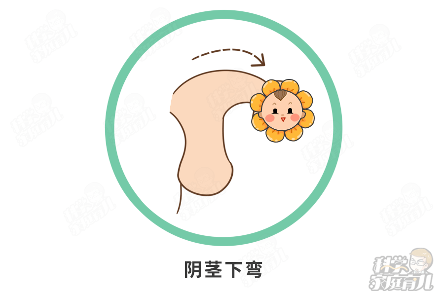 娃割包皮越早越好别犯傻早于这个年龄白挨一刀