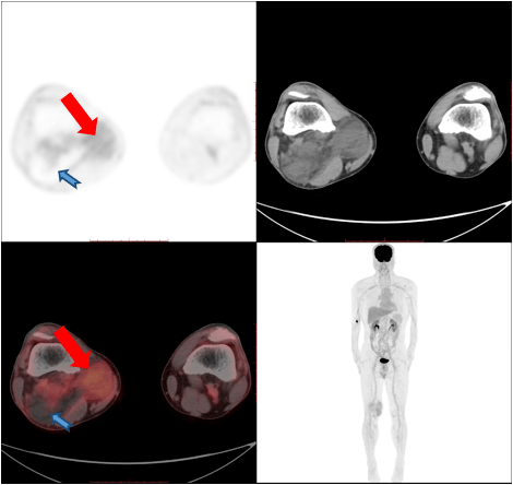  Difference Between CT and PET CT: Understanding the Distinctions