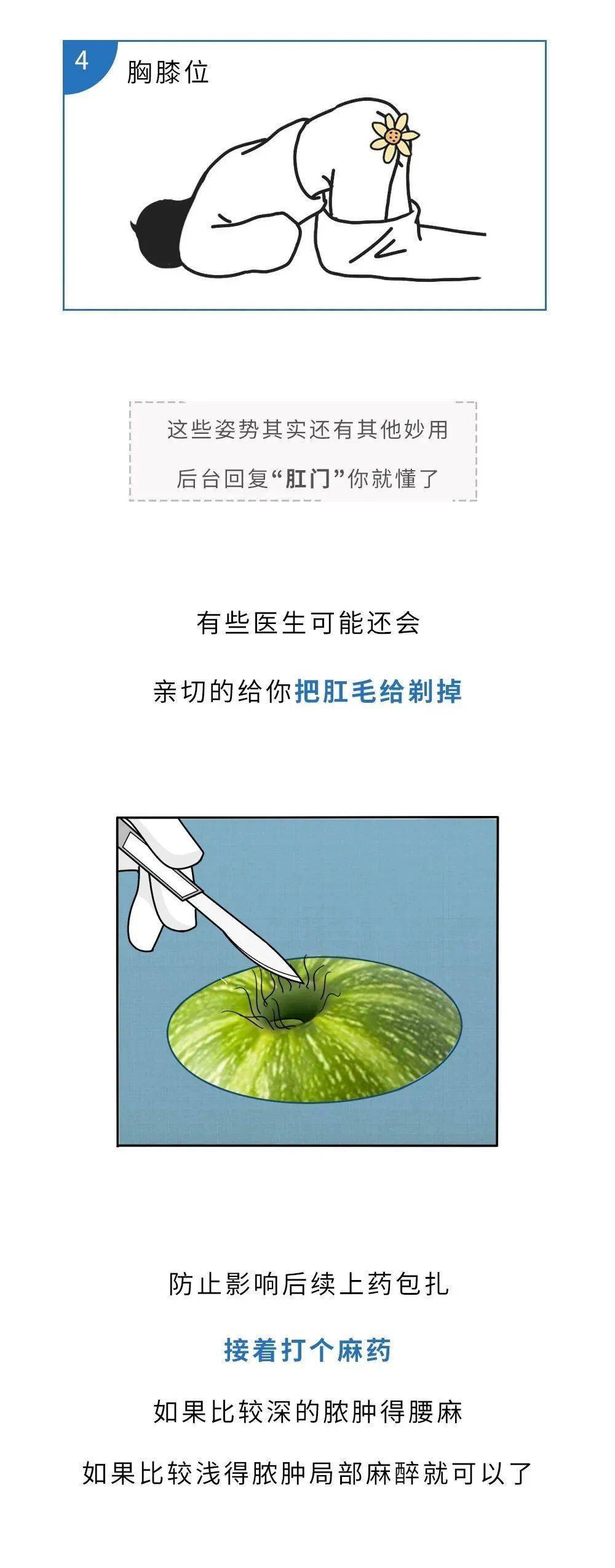 02_手术