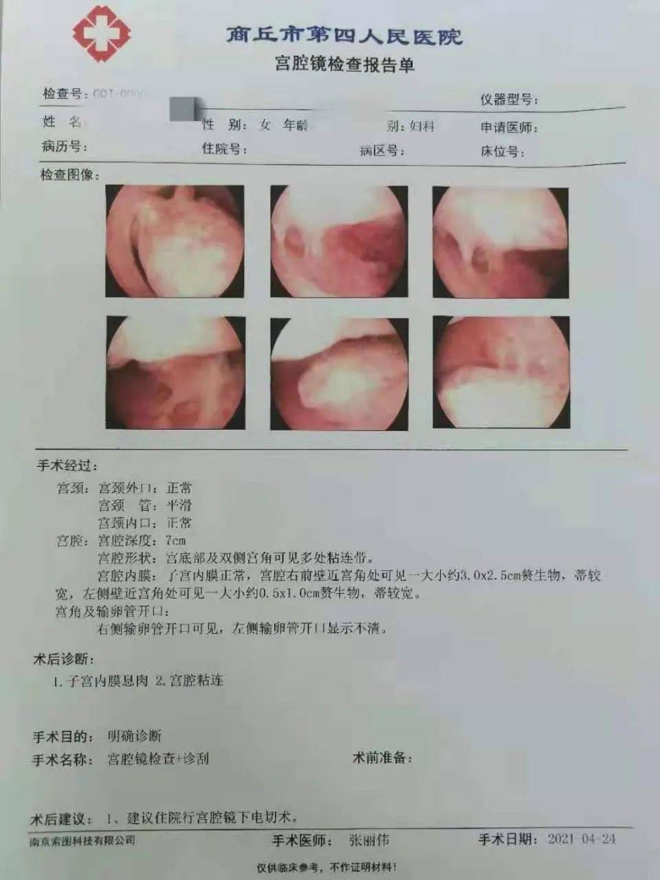 67商丘市第四人民医院妇产科开展新业务啦!_检查