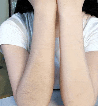 在不破坏毛囊的前提下,达到齐根断根脱毛