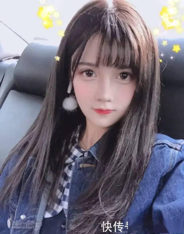 网红刘辉公开承认整容晒整容前后照片坦言最近又去动了骨头