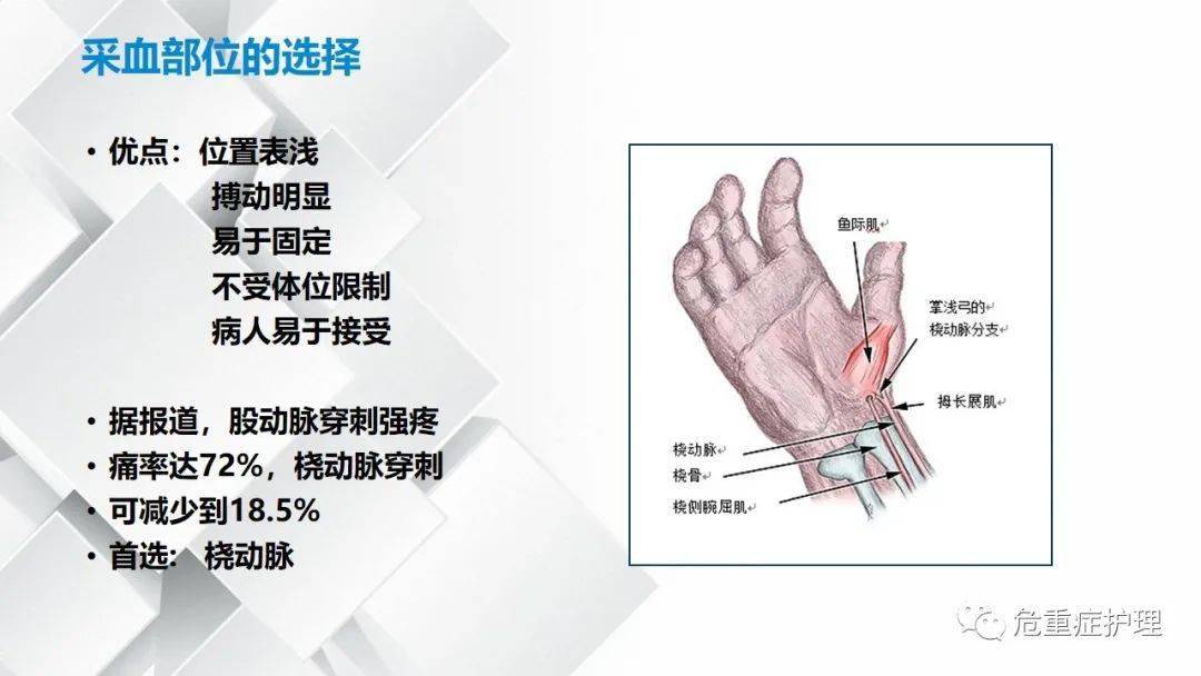 新生儿动脉采血定位图图片