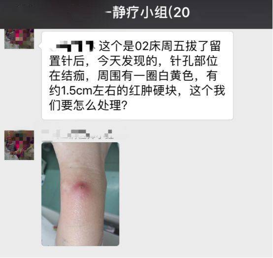 然而,一旦發生留置針併發症,則會事與願違.