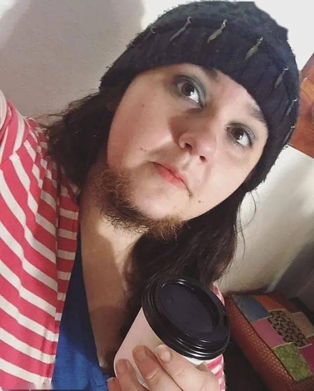 如今顶着这张脸自信生活!_阿尔玛·托雷斯