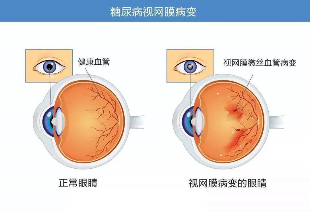 眼睛常患的疾病有哪些 保护眼睛的方法有哪些