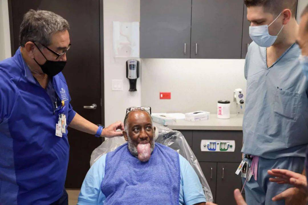 新冠康复者出现"巨舌症",舌头大到嘴装不下,只能切除部分舌头!