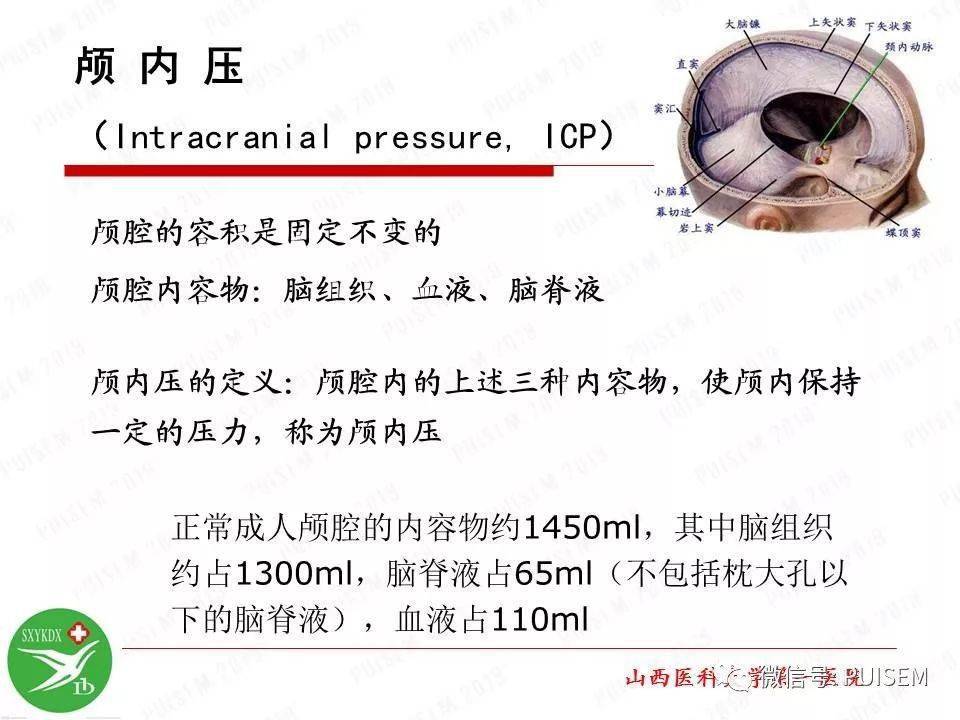 【ppt】颅内压的监测与管理