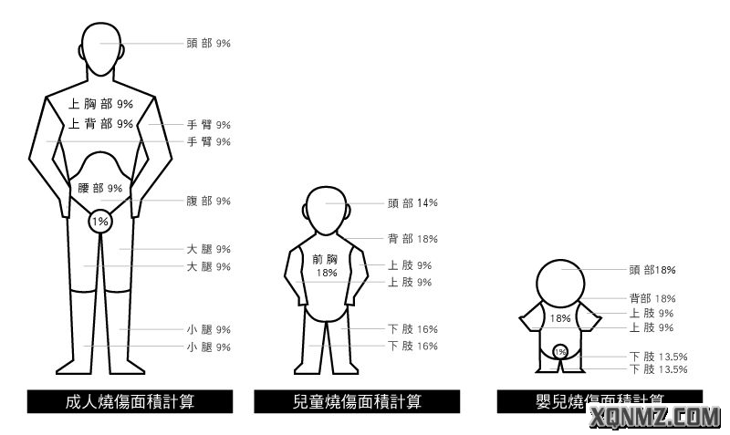 2,中國九分法:或特大面積燒傷(健康皮膚取減法)散在的小面積燒傷(燒傷